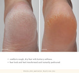 Farmhouse Fresh ENRICH MINT®
FOOT RESCUE MASK butter-soft heeling