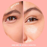 Patchology Bubbly Serve Chilled™Brightening Eye Gels